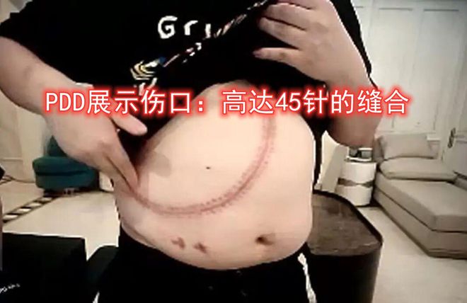4000名網(wǎng)癮少年電競夢碎：你以為躺著賺錢現(xiàn)實比高考還殘酷！(圖7)